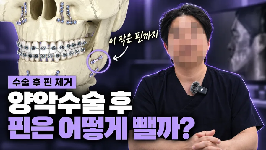 양악수술 후 핀 제거 설명 썸네일
